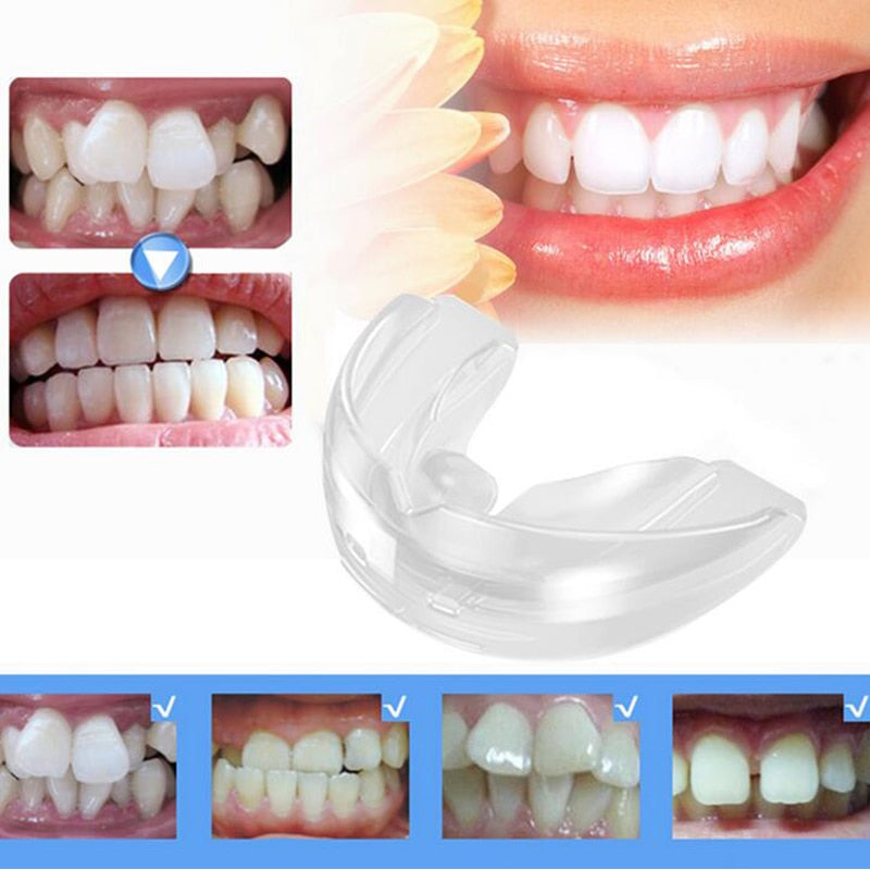Dental Orthodontic Teeth Corrector Braces Tooth Retainer Straighten Tools teeth capped Transparent - EssentialBoutiques 