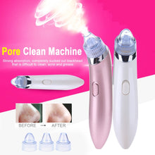 Load image into Gallery viewer, Pro Blackhead Vacuum Suction Pore Vacuum Cleaner Electric Acne Clean Exfoliating Cleansing Comedo Suction Pore Cleaner - EssentialBoutiques 