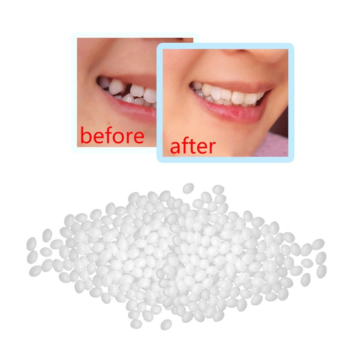 10g Denture Solid Glue Dental Restoration Temporary Tooth Repair Kit Teeth And Gaps FalseTeeth Solid Glue Denture Adhesive #40 - EssentialBoutiques 