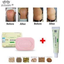 Load image into Gallery viewer, 1PC zudaifu Sulfur Soap add 1PC zudaifu Psoriis Cream Body Massage Patches Wholesale - EssentialBoutiques 